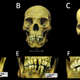 Imagen para el artículo titulado Tres esqueletos africanos encontrados en México muestran los horrores de la esclavitud temprana en el nuevo mundo